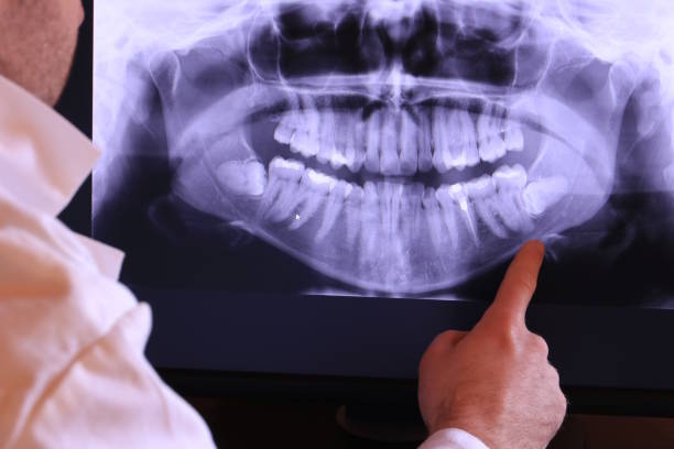 Best Emergency Tooth Extraction in Newnan, GA