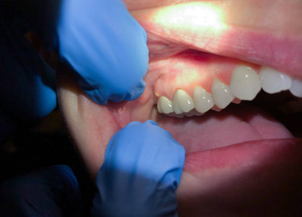 Best Weekend Emergency Dentist in Newnan, GA