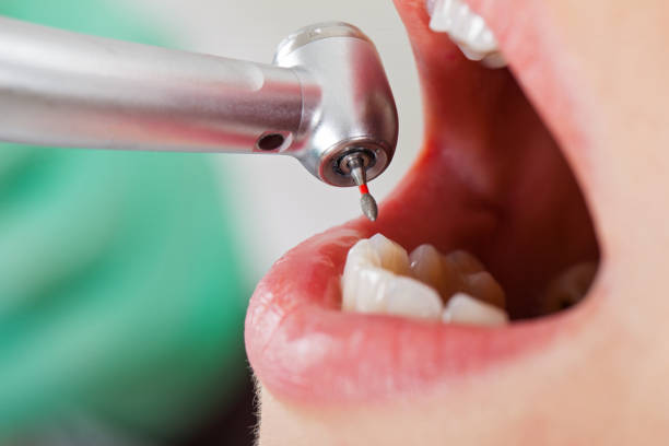 Best Emergency Orthodontic Repairs in Newnan, GA